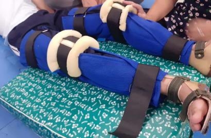 Caritas TGP Sài Gòn: Hoạt động Phục hồi chức năng cho trẻ khuyết tật vận động tại Mái ấm Teresa Calcutta